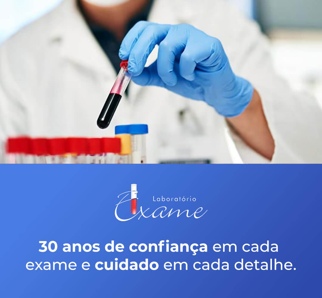 30-anos (1)