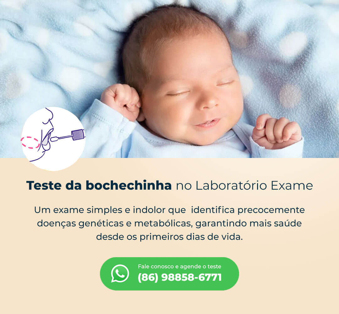 bochechinha-exame (1)